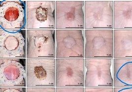 Científicos de Granada diseñan un biogel que acelera la cicatrización de las heridas en la piel