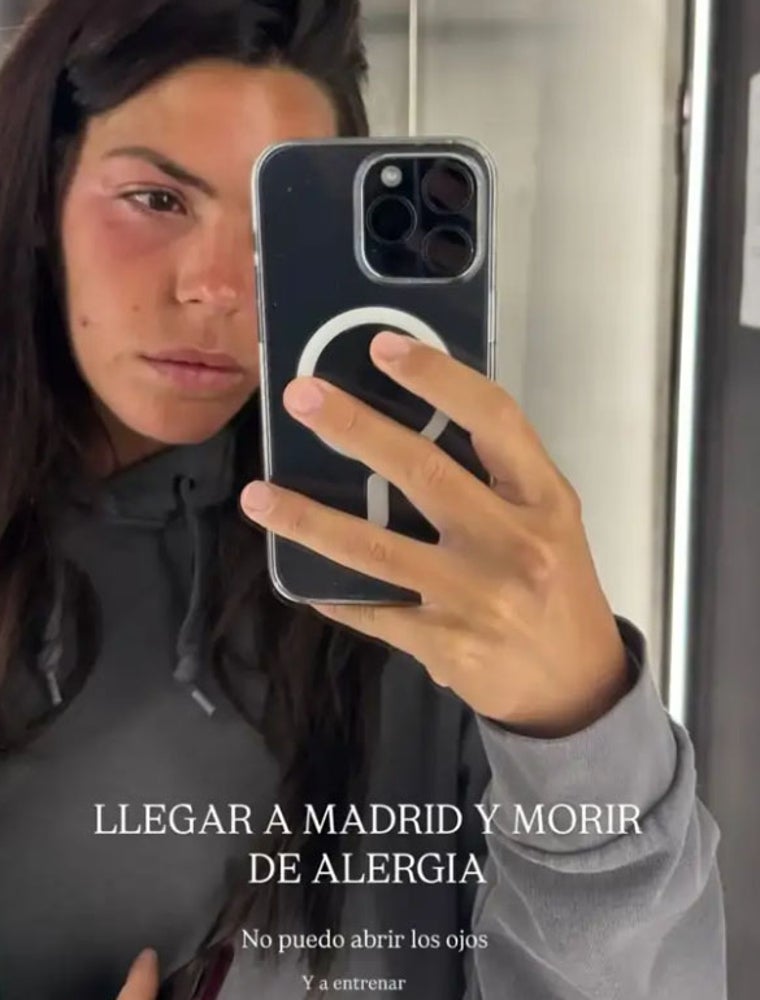 Laura Matamoros siembra la alarma: con la cara deformada y los ojos hinchados