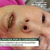 El 'infierno' de una octogenaria, secuestrada y maltratada por su cuidadora: «Una historia tremenda»