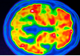 Así se repara el cerebro adulto para generar nuevas neuronas
